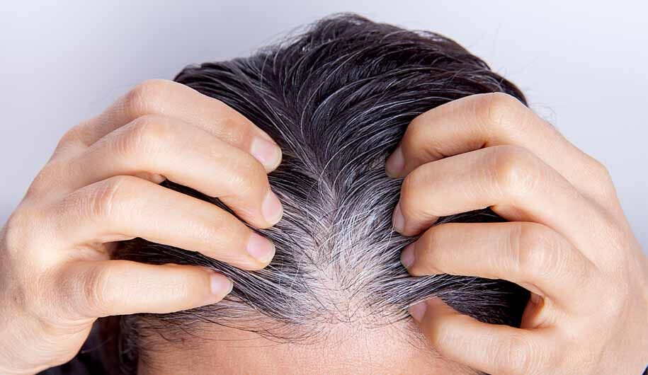 موهای کدام افراد در جوانی سفید میشود؟ موهای کدام افراد در جوانی سفید میشود؟