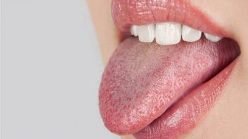 زبان درباره سلامتی چه میگوید؟ زبان درباره سلامتی چه میگوید؟