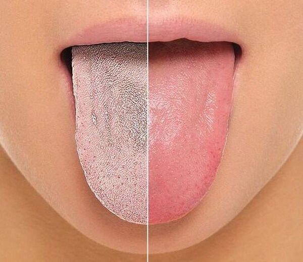 زبان درباره سلامتی چه میگوید؟