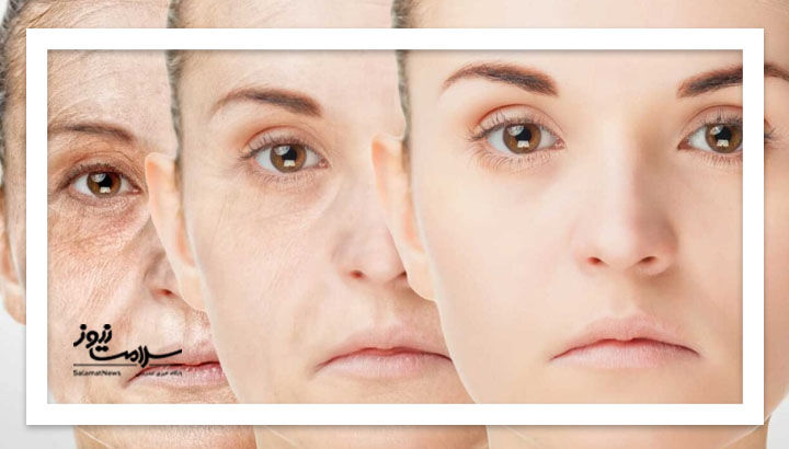 چگونه جوانسازی را تقویت کنیم؟ چگونه جوانسازی را تقویت کنیم؟