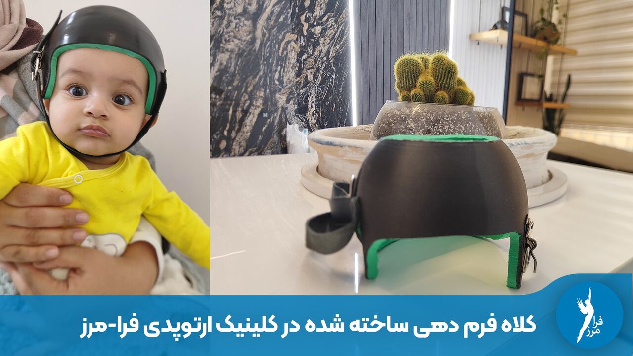 کلاه فرم دهی سر نوزاد: راهکاری برای داشتن سر متقارن کلاه فرم دهی سر نوزاد: راهکاری برای داشتن سر متقارن