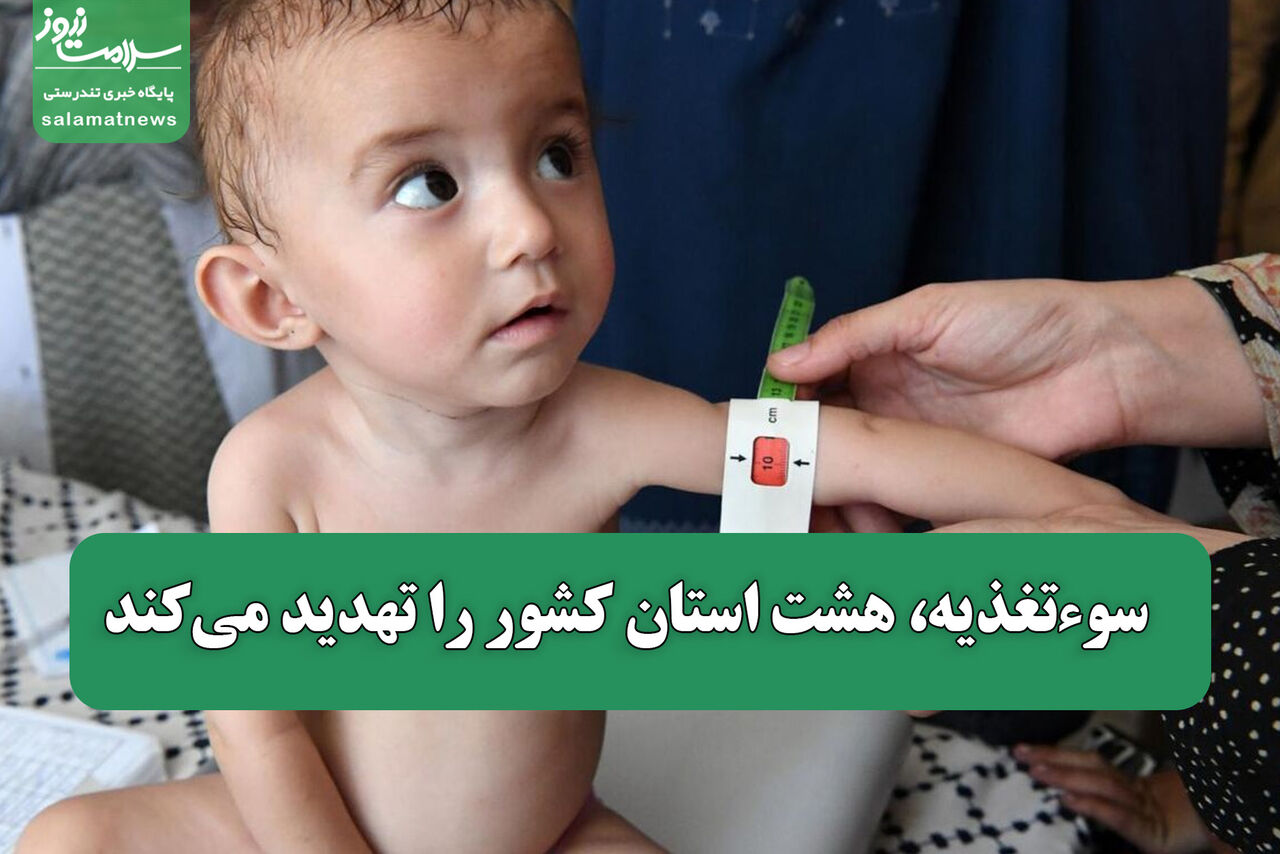 سوءتغذیه، هشت استان کشور را تهدید میکند  سوءتغذیه، هشت استان کشور را تهدید میکند