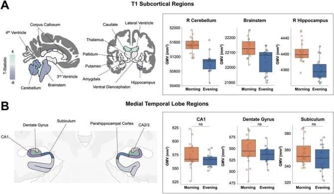 در کدام ساعت مغز مردان کوچک می شود؟