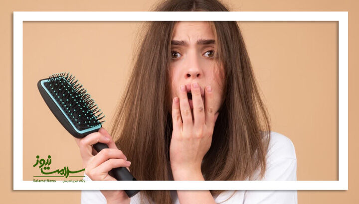راههای موثر برای جلوگیری از ریزش مو راههای موثر برای جلوگیری از ریزش مو