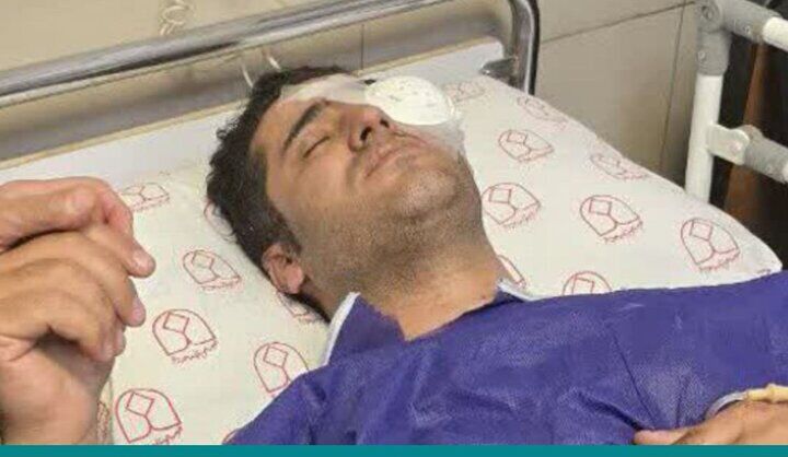 شلیک به چشم محیط بان موته اصفهان/ وضعیت چشم، وخیم است شلیک به چشم محیط بان موته اصفهان/ وضعیت چشم، وخیم است