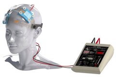 تجربه استفاده از TDCS در کلینیک طراوت تهرانسر