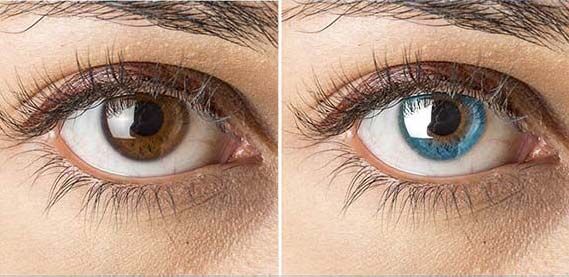 شدار درباره تغییر رنگ چشم: زیبایی با ریسکهای جدی! شدار درباره تغییر رنگ چشم: زیبایی با ریسکهای جدی!