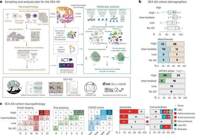 آلزایمر: آسیب پنهان و ویرانگر دو مرحلهای به مغز