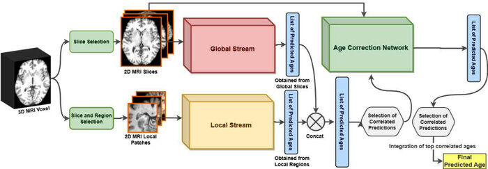 نوآوری محققان دانشگاه تهران در تشخیص زودهنگام بیماریهای مغزی
