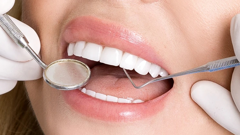 آیا میتوانیم در دوران بارداری از لمینت دندان استفاده کنیم؟