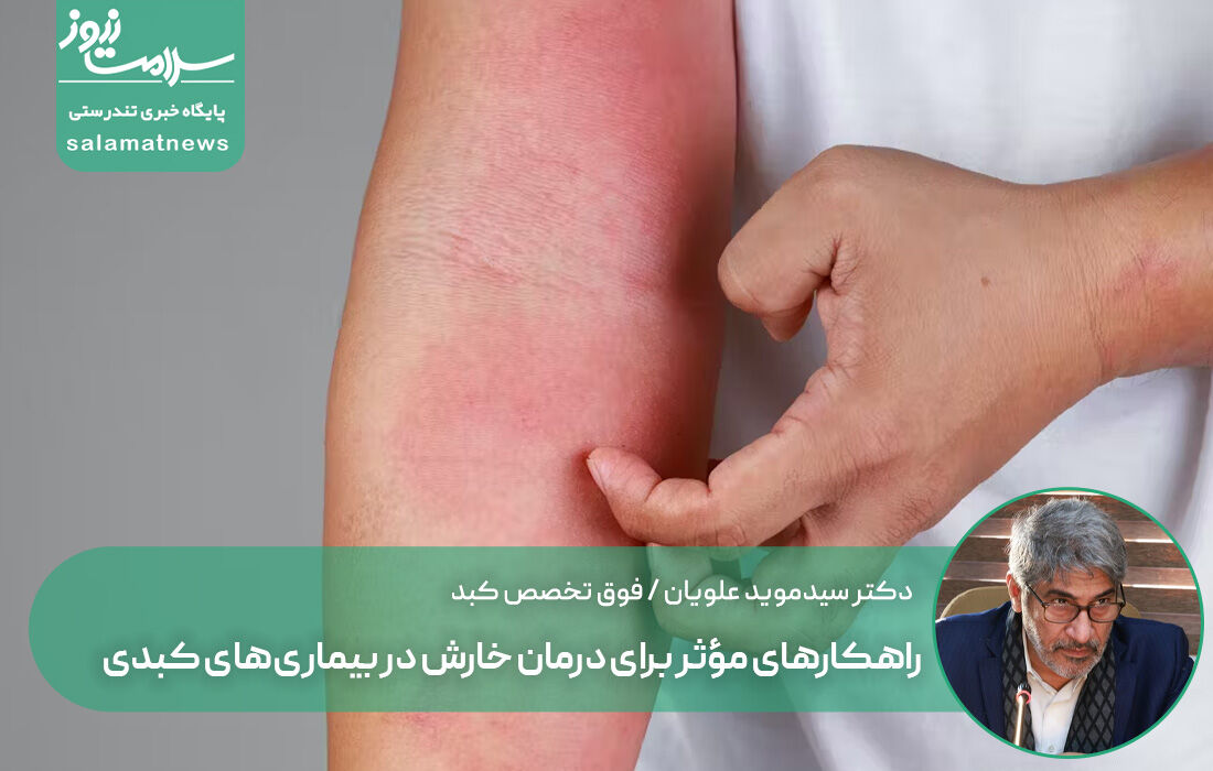 راهکارهای مؤثر برای درمان خارش در بیماریهای کبدی راهکارهای مؤثر برای درمان خارش در بیماریهای کبدی