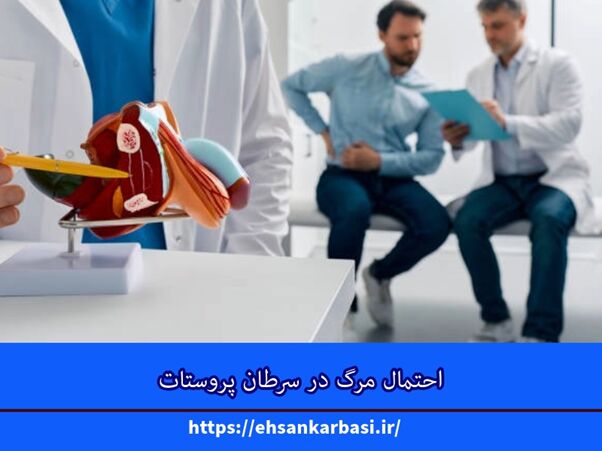 احتمال مرگ در سرطان پروستات + نکات بسیار مهم