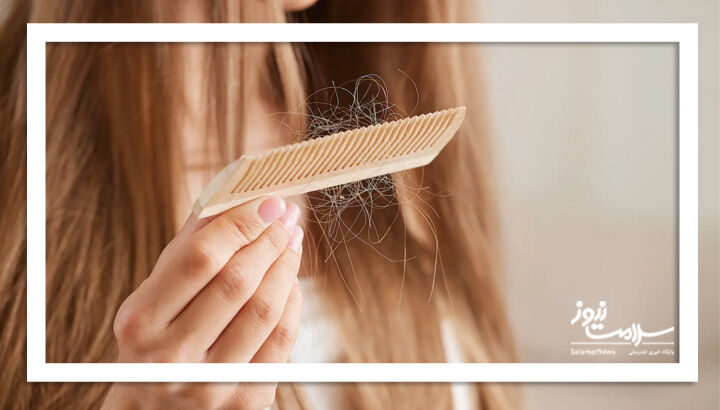 ۵ روش برای کاهش ریزش مو بدون دارو یا مکمل