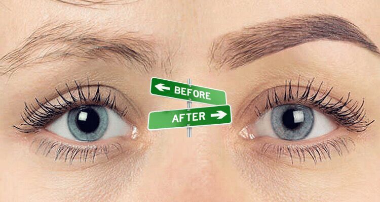 راهحلی دائمی برای ابروهای کمپشت؛ کاشت ابرو به سبک طبیعی راهحلی دائمی برای ابروهای کمپشت؛ کاشت ابرو به سبک طبیعی