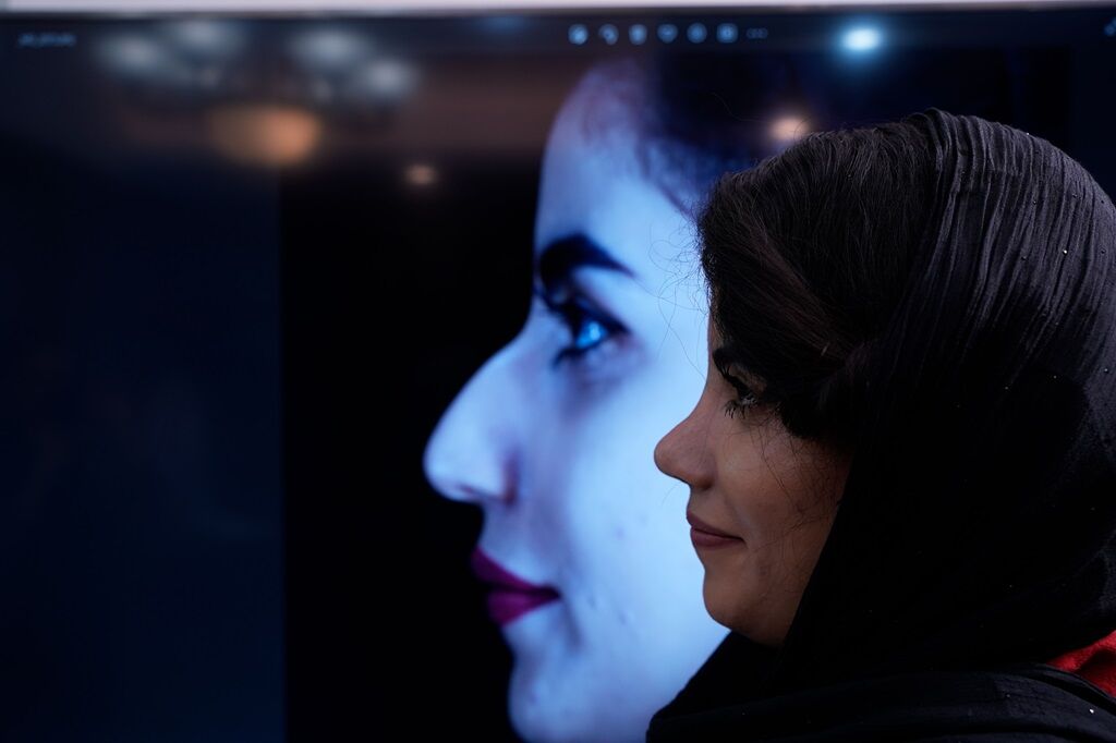 تفاوت عمل بینی بسته و باز: کدام روش برای شما مناسبتر است؟ تفاوت عمل بینی بسته و باز: کدام روش برای شما مناسبتر است؟