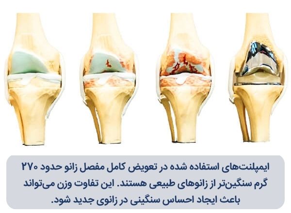 علت سنگینی پا بعد از عمل تعویض مفصل زانو