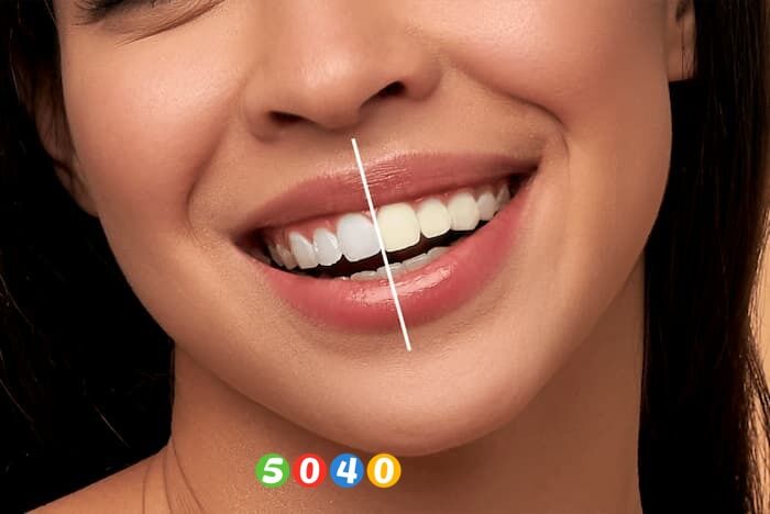 دندانهای خود را طبیعی سفید کنیم! دندانهای خود را طبیعی سفید کنیم!