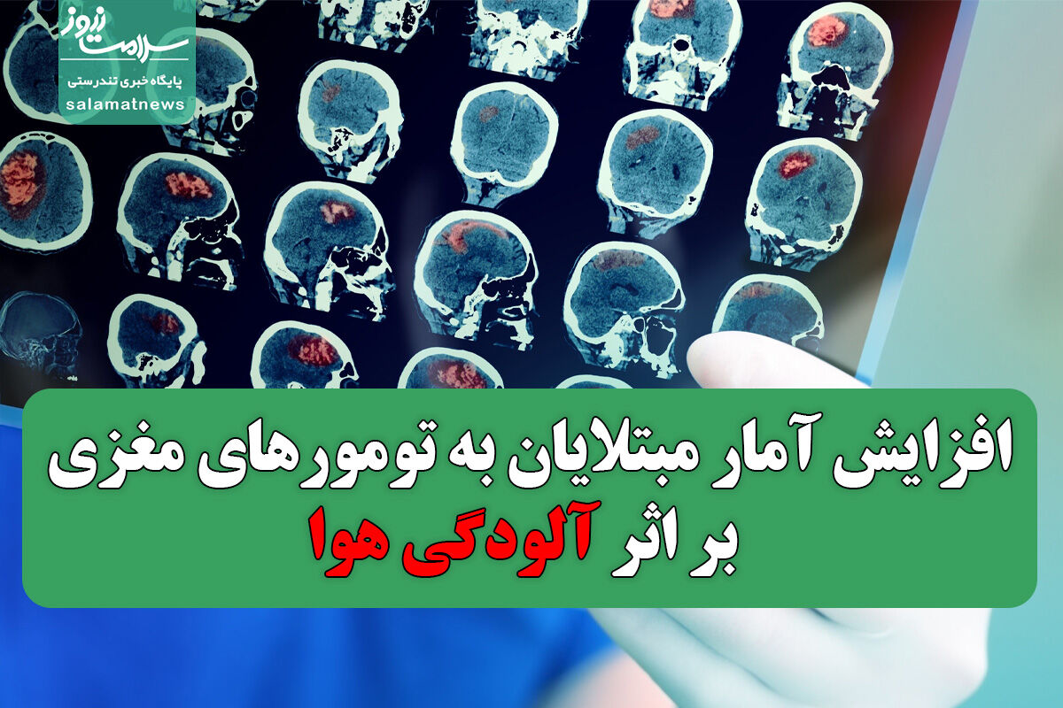 افزایش آمار مبتلایان به تومورهای مغزی بر اثر آلودگی هوا