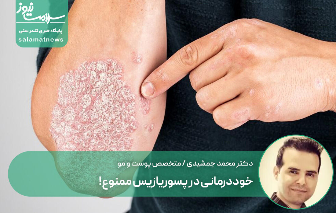 خوددرمانی در پسوریازیس ممنوع! خوددرمانی در پسوریازیس ممنوع!