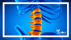 ترمیم شکستگی‌های ستون فقرات با سلول‌های بنیادی چربی؛ امیدی تازه برای بیماران پوکی استخوان