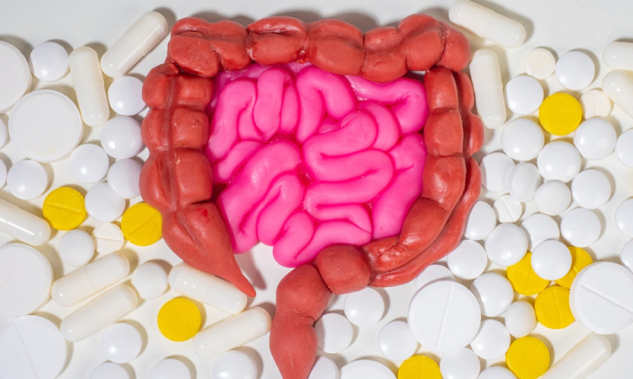 سرطان روده بعد از چند سال عود میکند؟