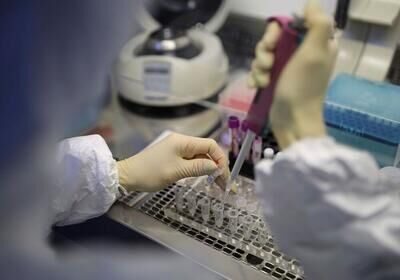 دفع سنگ کلیه با مکمل طبیعی ایرانی؛ دستاوردی نوآورانه برای سلامت عمومی دفع سنگ کلیه با مکمل طبیعی ایرانی؛ دستاوردی نوآورانه برای سلامت عمومی