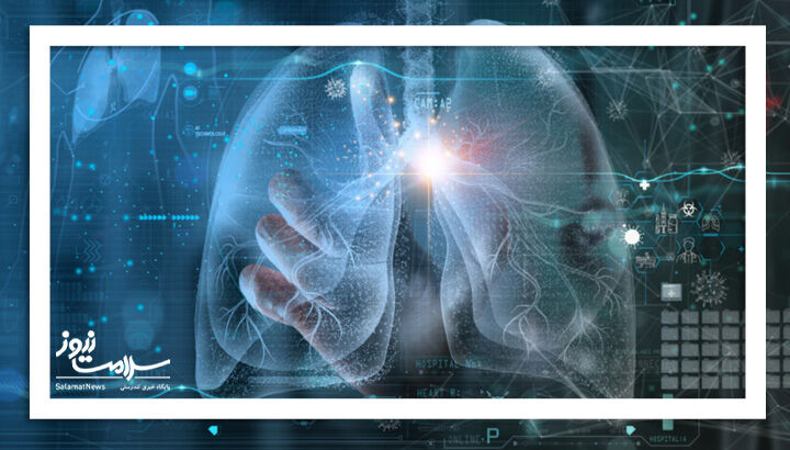 هوش مصنوعی بیماری های ریوی را با دقت بالایی تشخیص می دهد هوش مصنوعی بیماری های ریوی را با دقت بالایی تشخیص می دهد