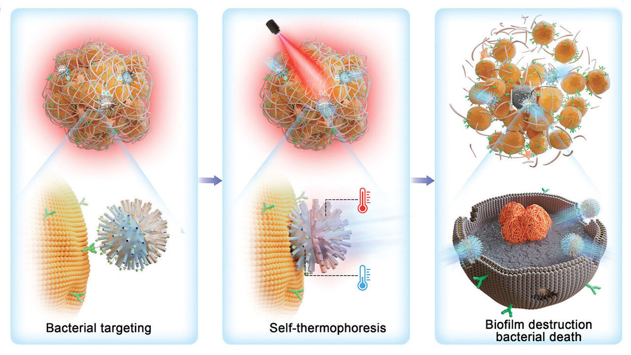 نابودی باکتریهای مقاوم به آنتیبیوتیک با نانو رباتها؛ انقلابی در درمان عفونتهای چشمی نابودی باکتریهای مقاوم به آنتیبیوتیک با نانو رباتها؛ انقلابی در درمان عفونتهای چشمی