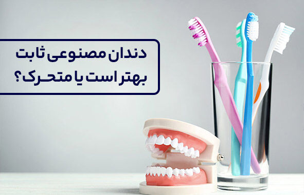 دندان مصنوعی ثابت بهتر است یا متحرک؟ دندان مصنوعی ثابت بهتر است یا متحرک؟