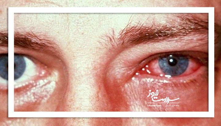 نشانههای یک بیماری چشمی که نیاز به پیگیری فوری دارد نشانههای یک بیماری چشمی که نیاز به پیگیری فوری دارد