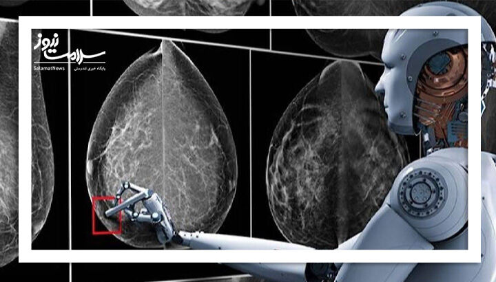 هوش مصنوعی و توانایی آن در شناسایی سرطان پستان شش سال پیش از ابتلا هوش مصنوعی و توانایی آن در شناسایی سرطان پستان شش سال پیش از ابتلا