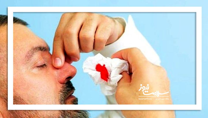 چرا خون دماغ میشویم؟ چرا خون دماغ میشویم؟