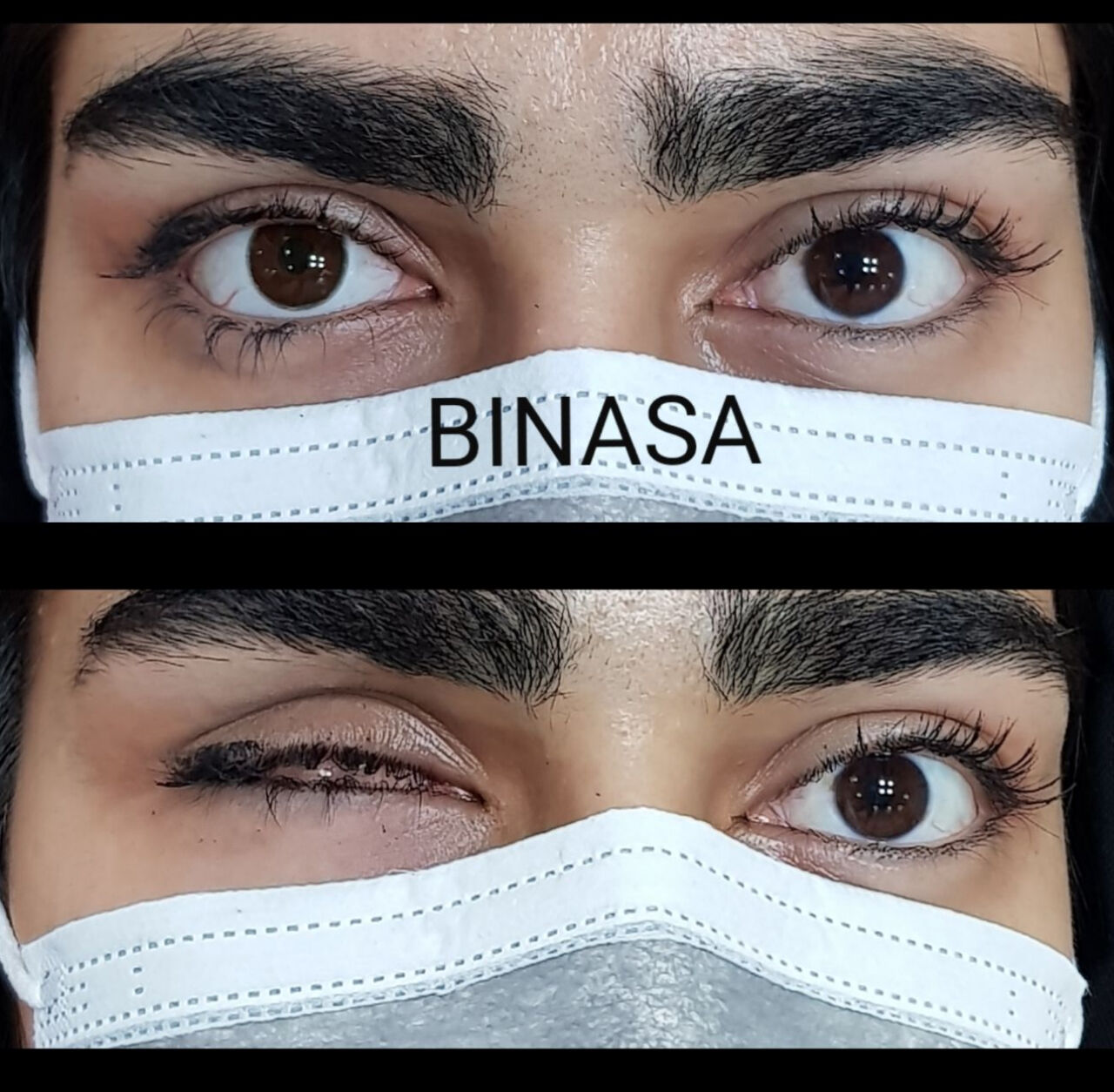 بهبود زیبایی ظاهری با پروتز چشم بهبود زیبایی ظاهری با پروتز چشم