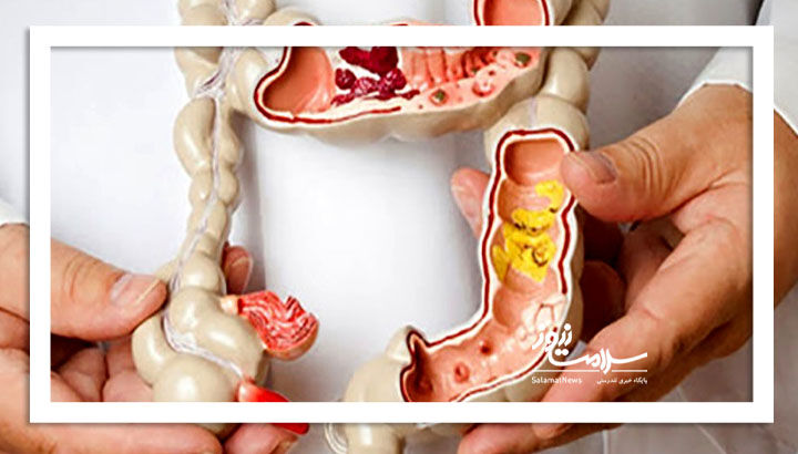 چگونه یبوست را درمان کنیم؟ چگونه یبوست را درمان کنیم؟