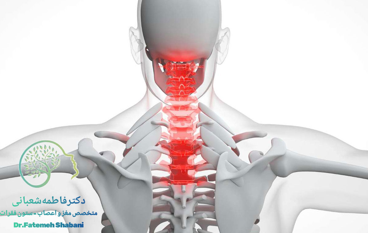 دیسک گردن باعث چه دردهایی می‌شود؟