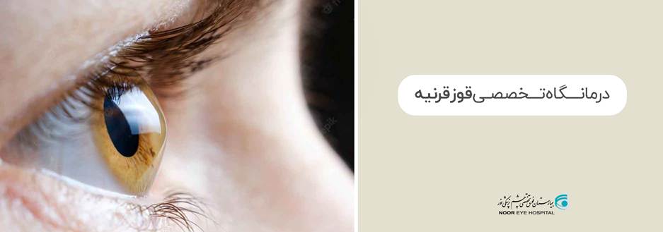 راهاندازی ۳ درمانگاه فوق تخصصی چشم در بیمارستان نور