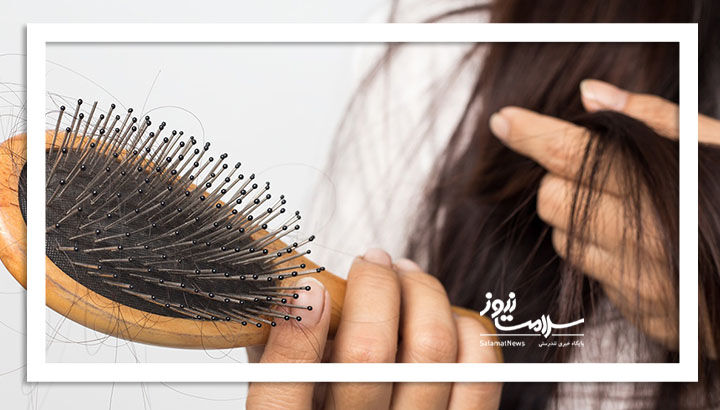 چرا موهای ما دچار ریزش میشوند؟ چرا موهای ما دچار ریزش میشوند؟