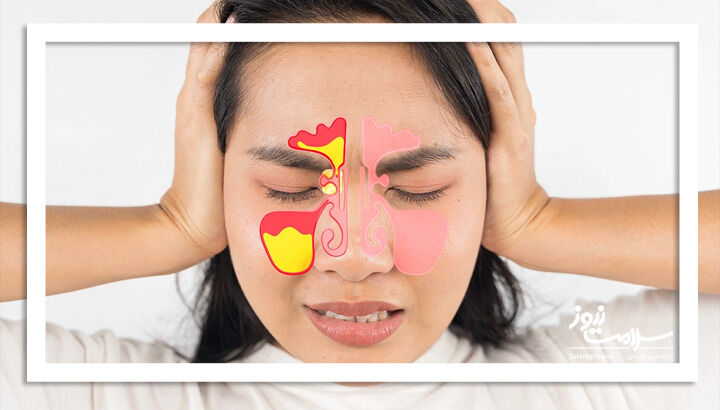 درمان خانگی برای تسکین مشکلات سینوس ها درمان خانگی برای تسکین مشکلات سینوس ها