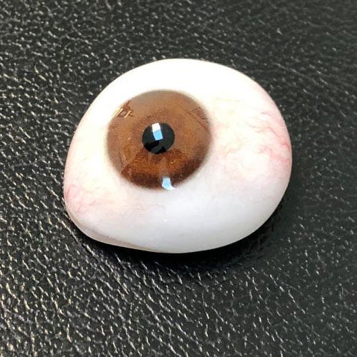 بازسازی چهره و پیشگیری از عوارض پس از تخلیه چشم با پروتزهای چشمی پیشرفته