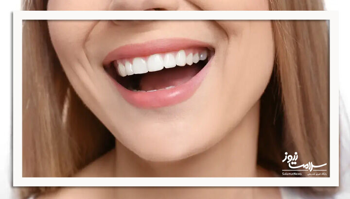 مراقبت از سلامت لثه، کلید پیشگیری از مشکلات جدی دندانی مراقبت از سلامت لثه، کلید پیشگیری از مشکلات جدی دندانی