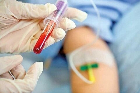 تشدید نظارت بر جمع‌آوری پلاسما و شفاف‌سازی در این حوزه ضروری است