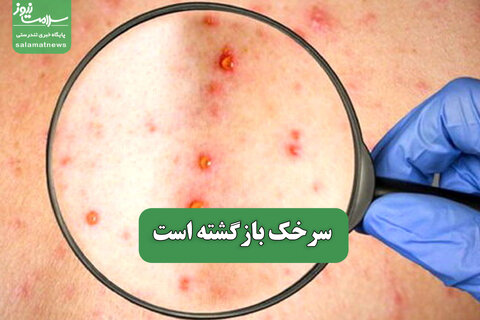 سرخک بازگشته است