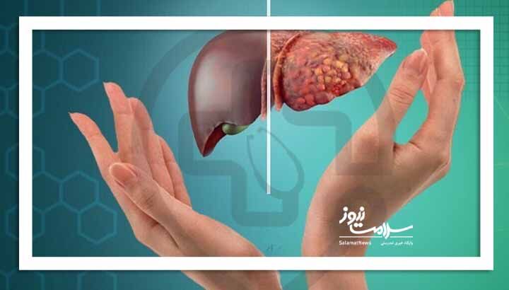 نسخه جادویی طب ایرانی برای حفاظت از کبد و کلیه نسخه جادویی طب ایرانی برای حفاظت از کبد و کلیه