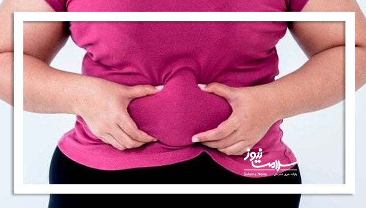 چرا به چاقی شکمی مبتلا می‌شویم؟
