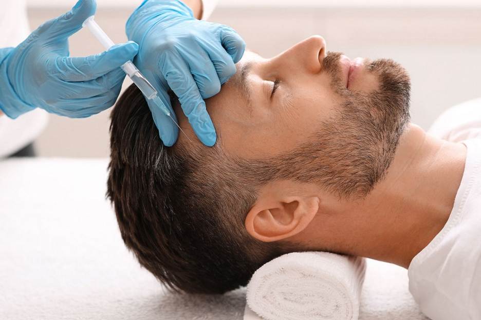 مزوتراپی مو چگونه انجام می شود؟