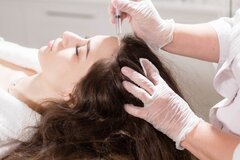 مزوتراپی مو چگونه انجام می شود؟