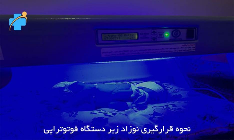 اجاره دستگاه زردی نوزاد از زردی طب کلینیک
