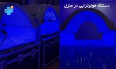 اجاره دستگاه زردی نوزاد از زردی طب کلینیک