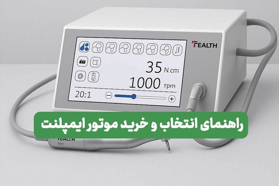راهنمای انتخاب و خرید موتور ایمپلنت