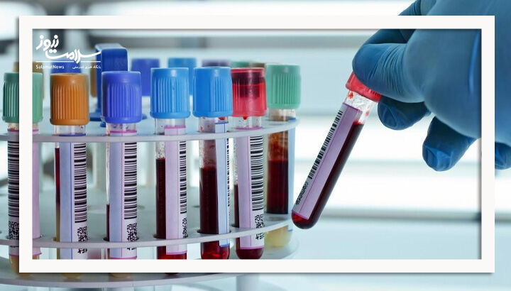 اولین آزمایش خون برای تشخیص آلزایمر تایید شد